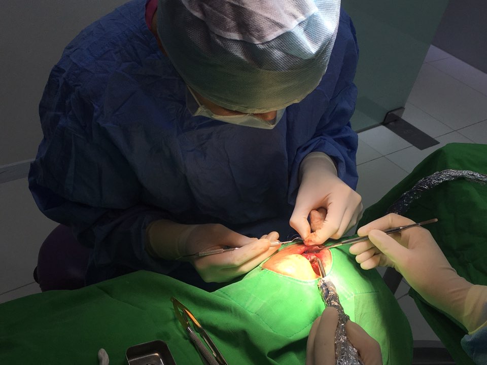 앞니 임플란트_뼈이식_신논현역 치과_아름드리 치과 관련 이미지 22