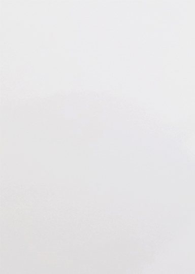 신논현라미네이트 심미성과 치아건강을 한번에 관련 이미지 5