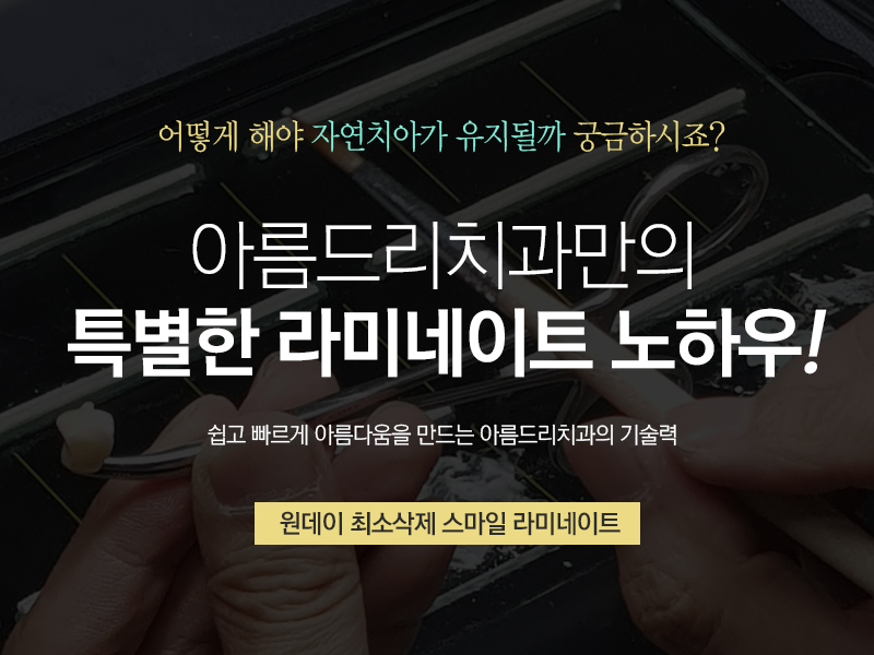 앞니돌출 래미네이트 비용과 가격은? 관련 이미지 5