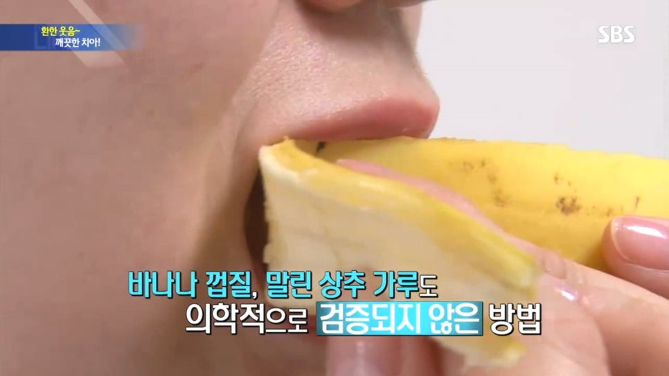 SBS 생활경제-이현정원장님 치아미백 인터뷰 관련 이미지 8