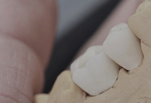 신논현라미네이트 고민만 하고 있다면 관련 이미지 22