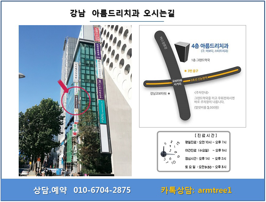 덧니 교정, 악궁 확장장치, 쁘띠 교정_신논현역 아름드리치과 관련 이미지 20