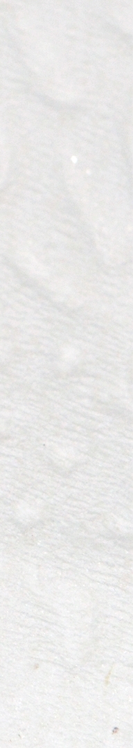 신논현치과 사랑니발치 치과는 신중하게 관련 이미지 14