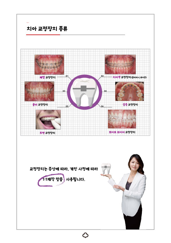 치아교정 후 유지 장치 세척&관리법 Tip_강남 아름드리 치과 관련 이미지 17