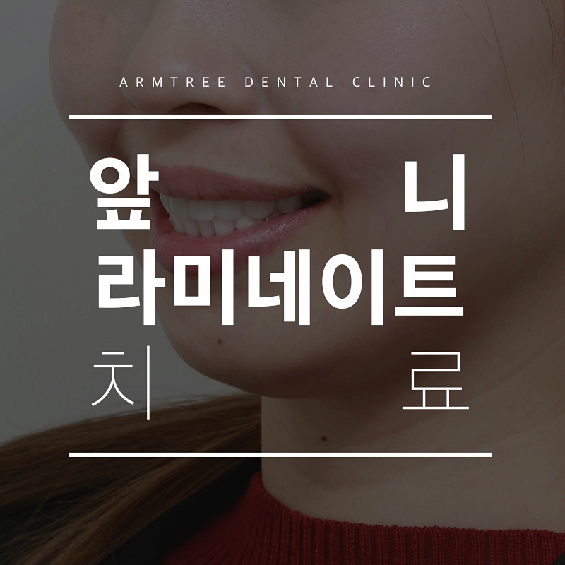 앞니라미네이트 부작용없는선택 아름드리치과 관련 이미지 1