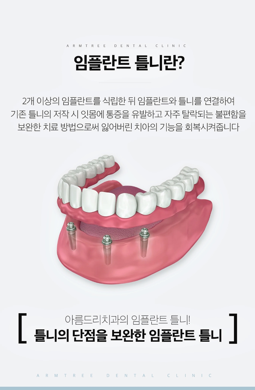 신논현치과 임플란트틀니로 치료부담을 줄인다면 관련 이미지 3