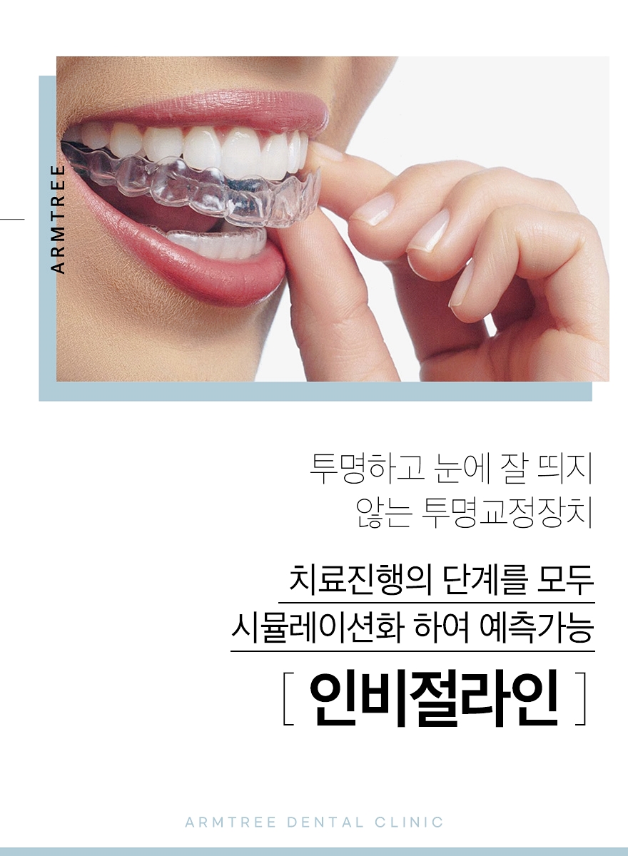 3D 구강스캐너 아이테로를 통한 치아교정 아름드리치과 관련 이미지 2