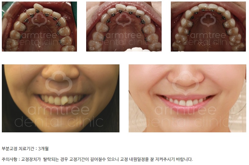 [부분교정] 티안나게. 빠르게. 투명하게 관련 이미지 2