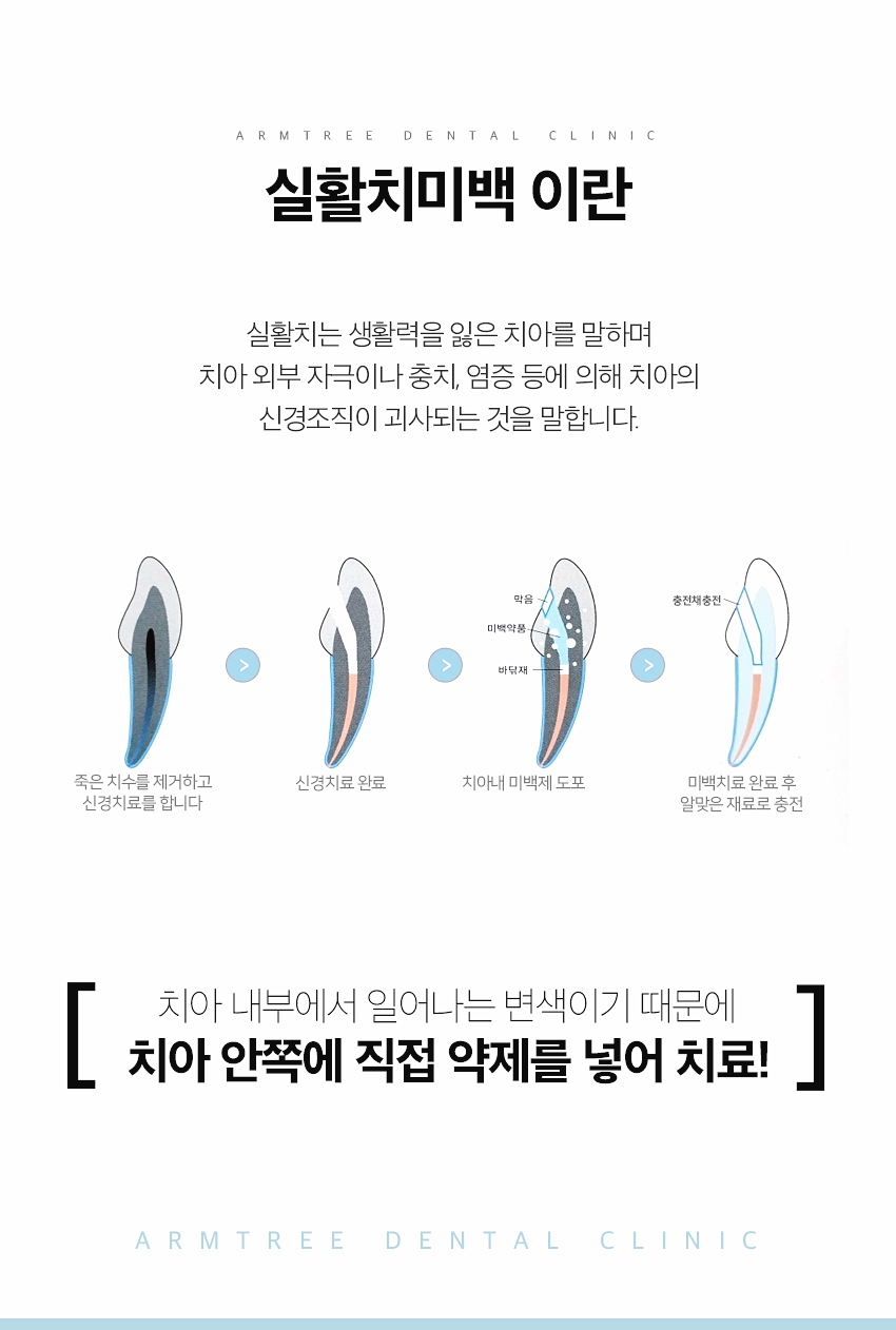 실활치미백 앞니변색 후기는 관련 이미지 3