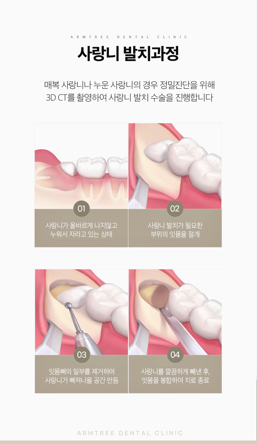 신논현역 사랑니발치는 체계적인 아름드리치과 관련 이미지 6