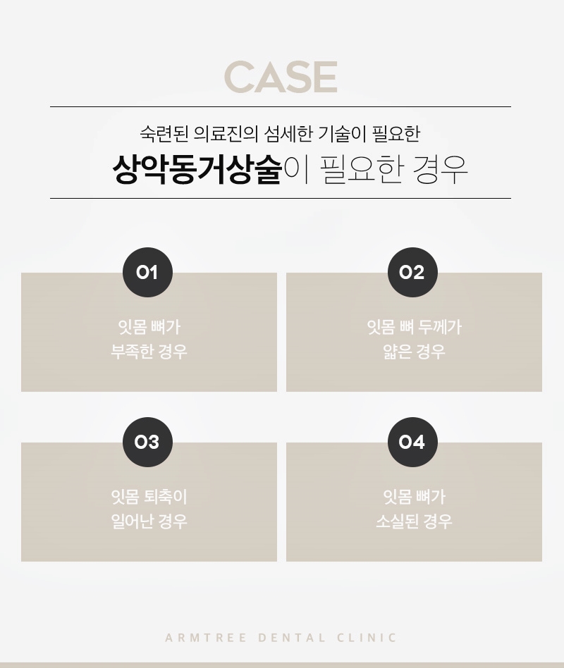 신논현역치과 상악동거상술과 임플란트는 아름드리치과에서 관련 이미지 6