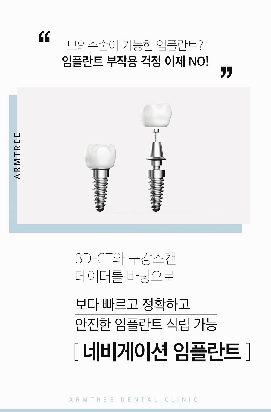 네비게이션임플란트 꼼꼼히 따져보면 관련 이미지 2