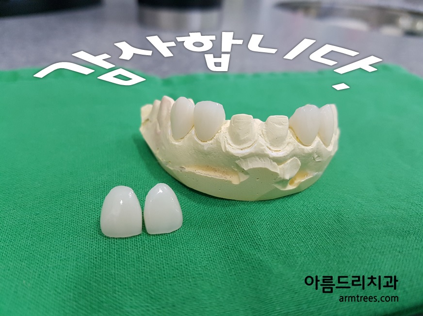 [신논현치과]아름드리치과 이0열님 치료 후기 감사합니다. 관련 이미지 2