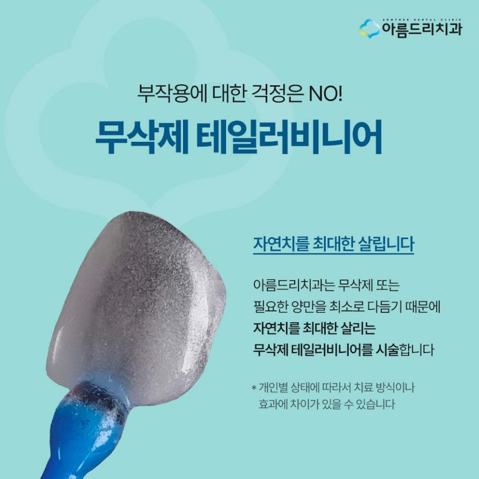 강남 연예인들이 많이 찾는 치아성형 자연스러운 무삭제 라미네이트 치아성형 관련 이미지 3