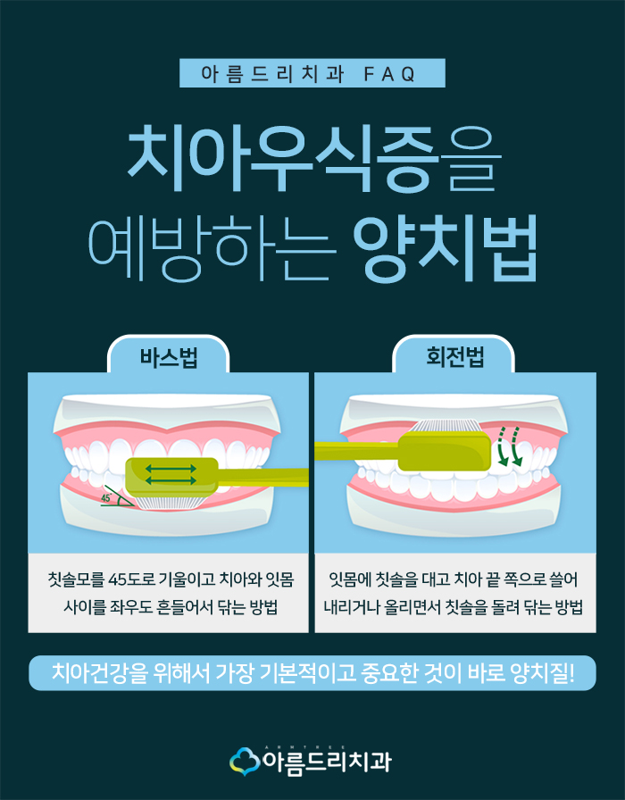 치아우식증 치료 증상과 예방법 관련 이미지 10