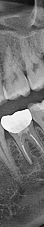반포치과 사랑니발치 치과를 찾고있다면 관련 이미지 11