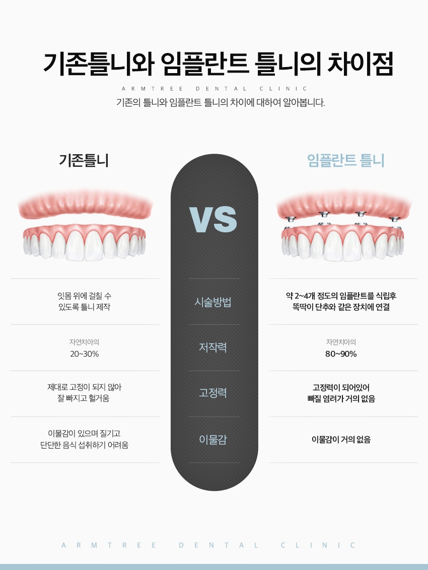 신논현치과 임플란트틀니로 치료부담을 줄인다면 관련 이미지 4