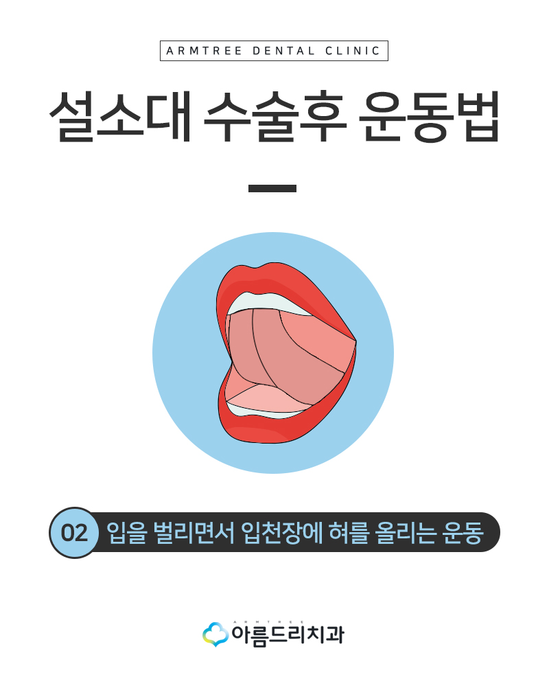 성인설소대수술 단축증 비용과 후기 관련 이미지 8