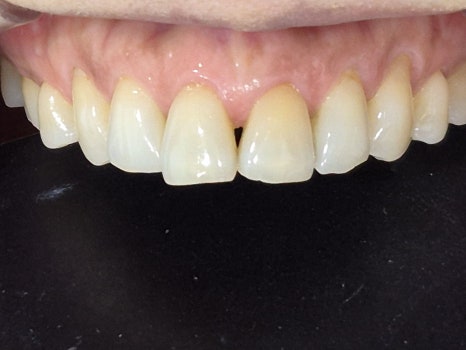 테일러 비니어 (진료일기) 관련 이미지 7