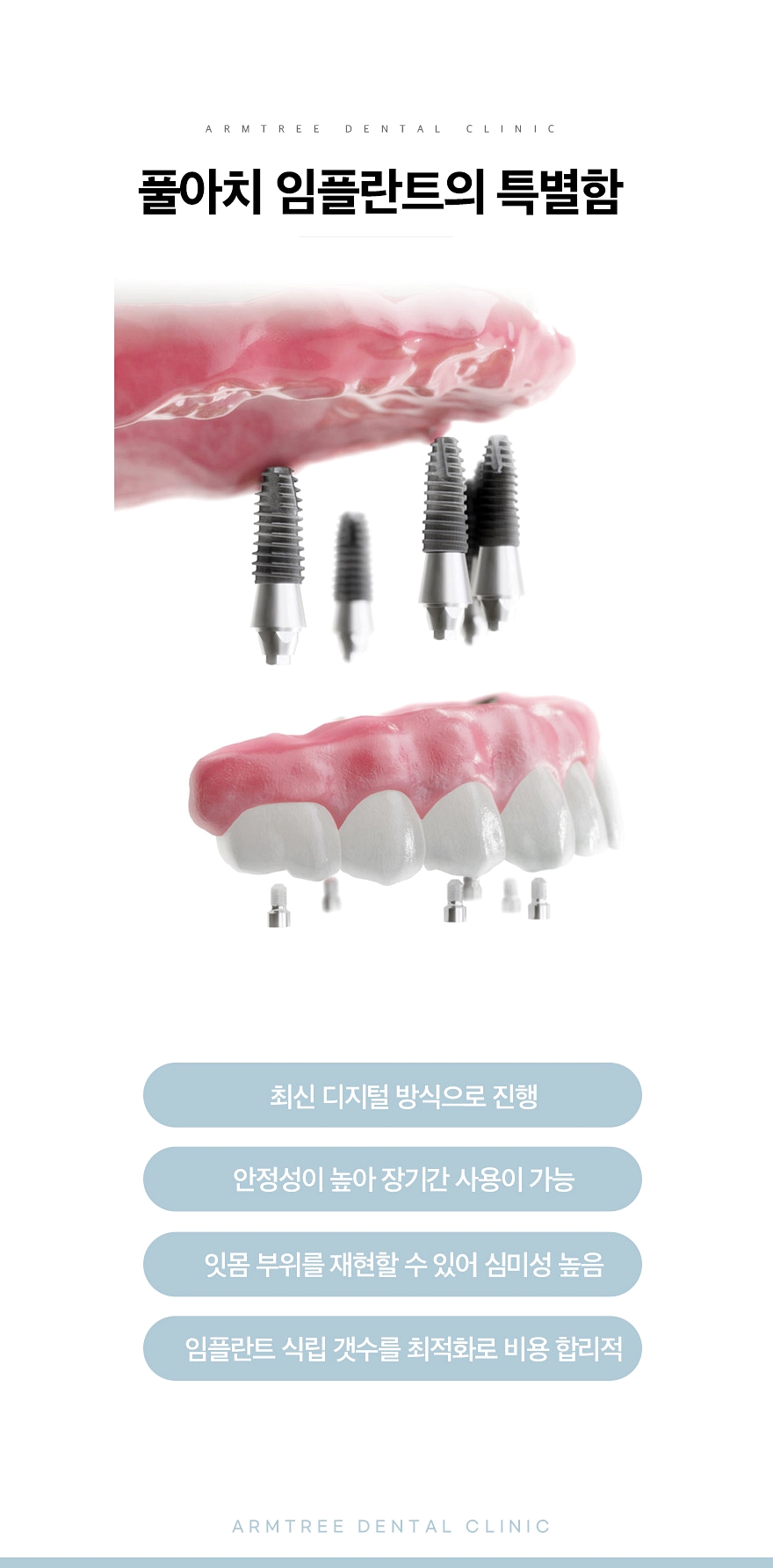 신논현역치과 전체임플란트가 궁금하다면 관련 이미지 5