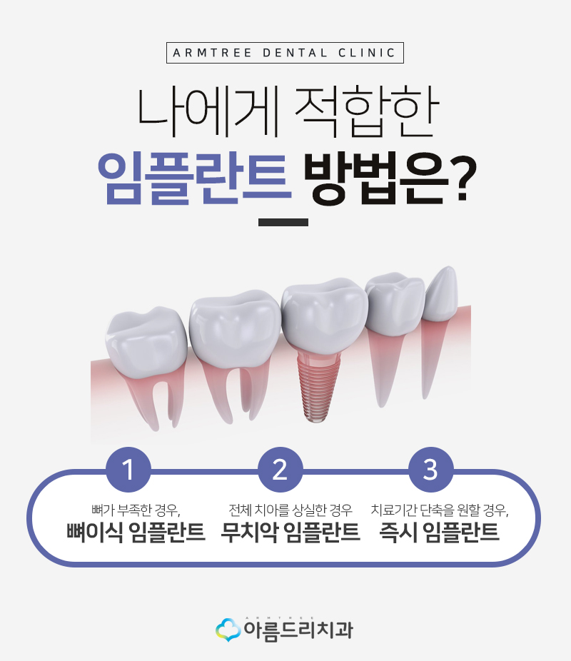 인플란트통증 걱정없는 디지털임플란트 관련 이미지 3