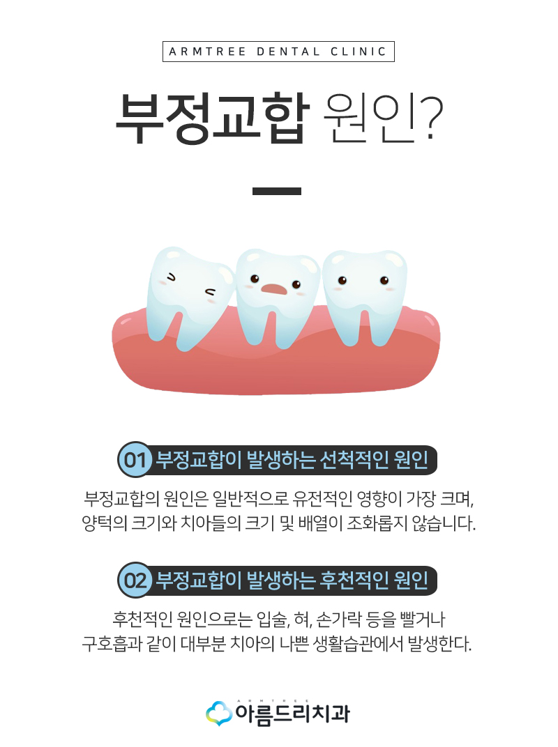치아부정교합교정 악궁확장장치 후기는? 관련 이미지 7