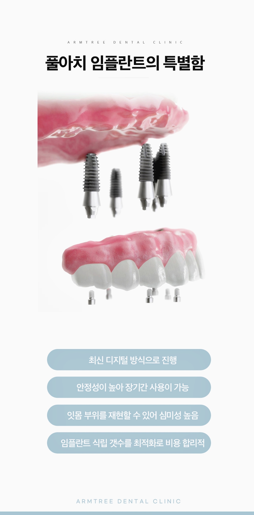 신논현역 전체임플란트는 풀아치임플란트로 관련 이미지 5