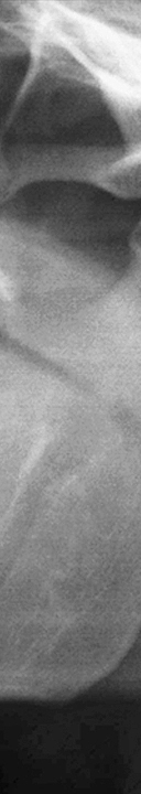 신논현역치과 사랑니 발치를 원한다면 관련 이미지 14