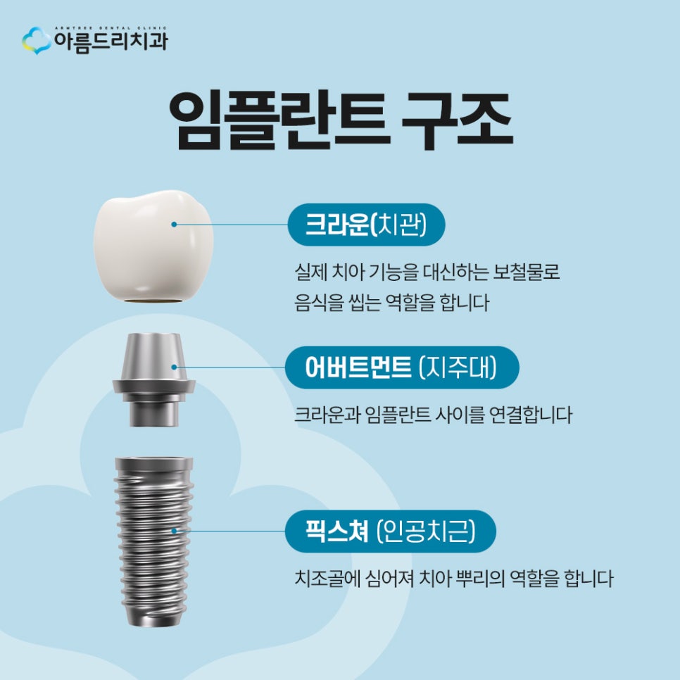강남 임플란트 시술 후 통증 원인, 통증 줄이는 방법, 주의사항 관련 이미지 4