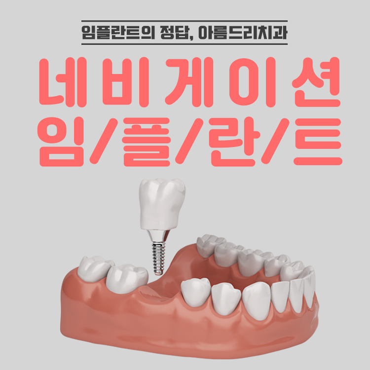 네비게이션임플란트 부작용은 저리가 관련 이미지 1