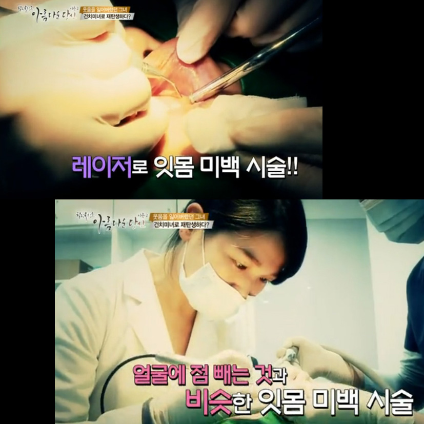 이현정원장의 아름다운 당신 시즌 2 (4회 김양경 도전자) 잇몸미백과 치아미백 관련 이미지 5