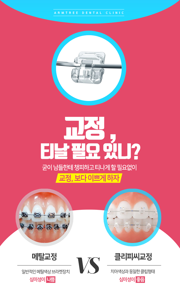 클리씨피교정 자가결찰교정 아름드리 관련 이미지 3