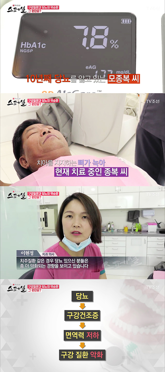 TV조선 스페셜 50회 구강건강관리 관련 이미지 7