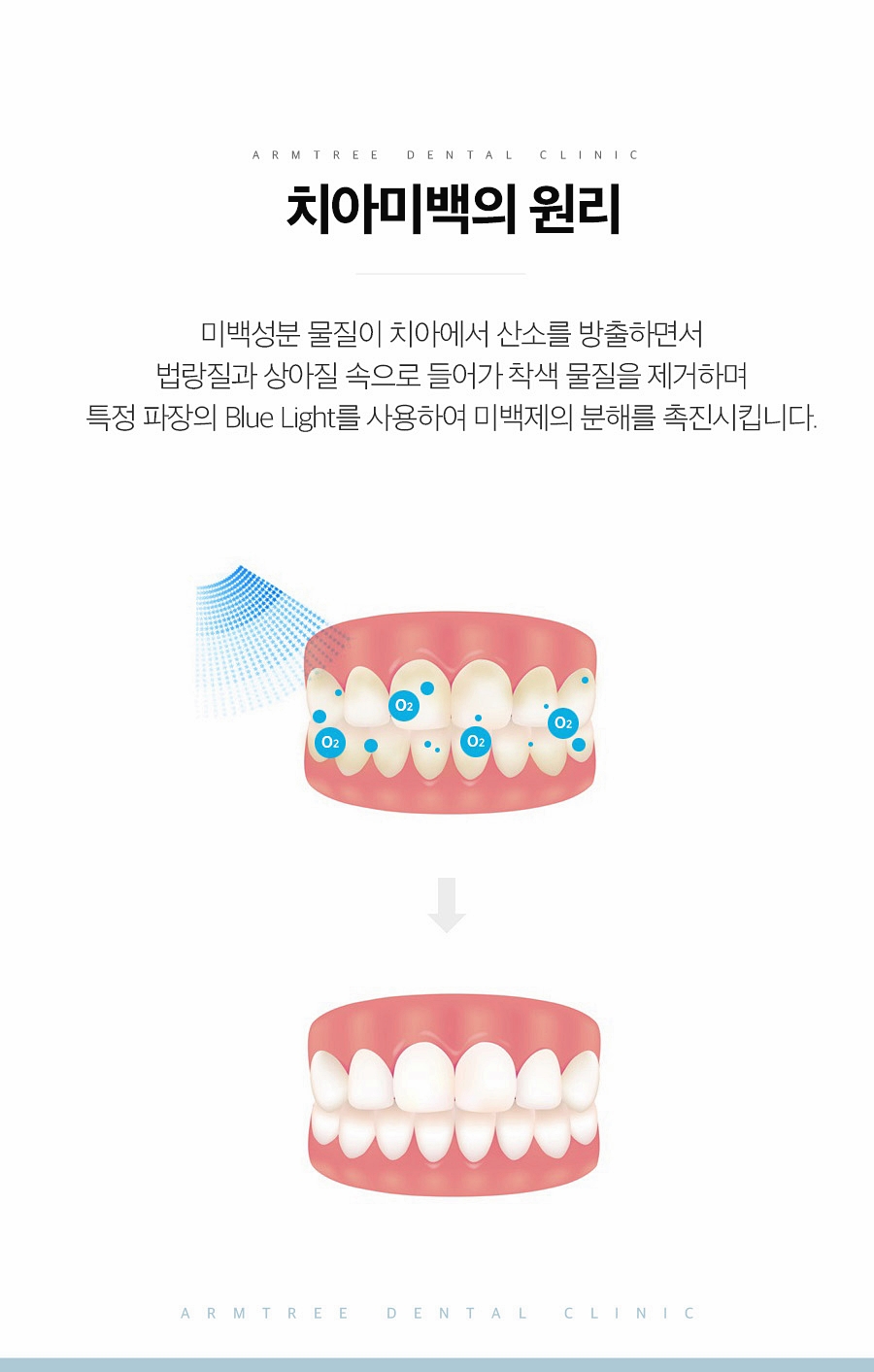 신논현역 치과치아미백 자신감 찾기! 관련 이미지 6