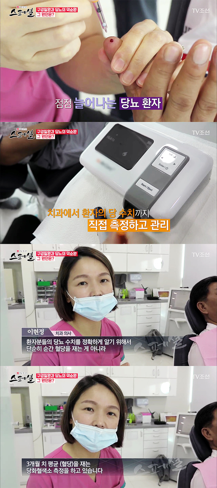 TV조선 스페셜 50회 구강건강관리 관련 이미지 6
