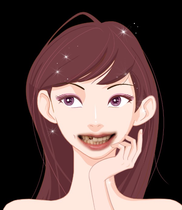 앞니 크라운 재치료 & 잇몸성형 _건강하게 . 예뻐지는 방법 관련 이미지 3