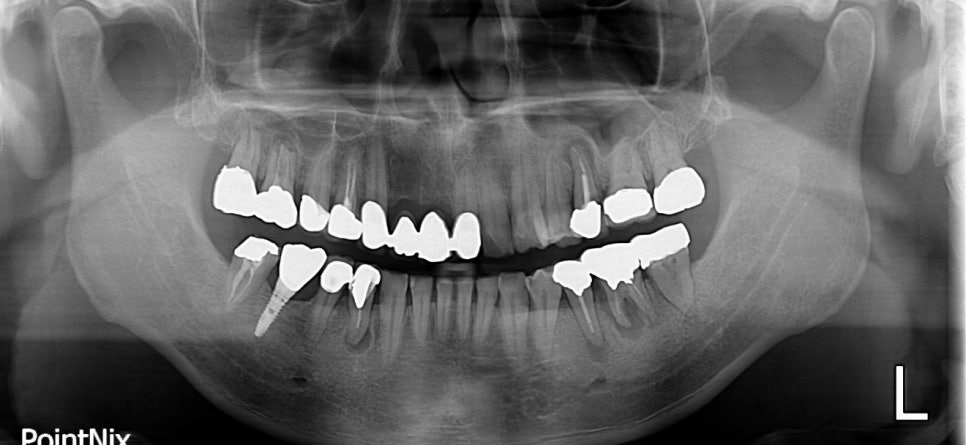 당뇨병과 잇몸병?(당뇨합병증 이겨내기) 관련 이미지 3