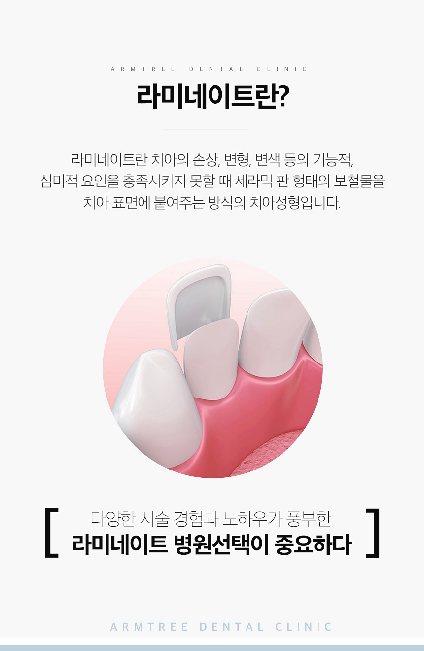 연예인라미네이트 신논현역 아름드리치과 관련 이미지 3