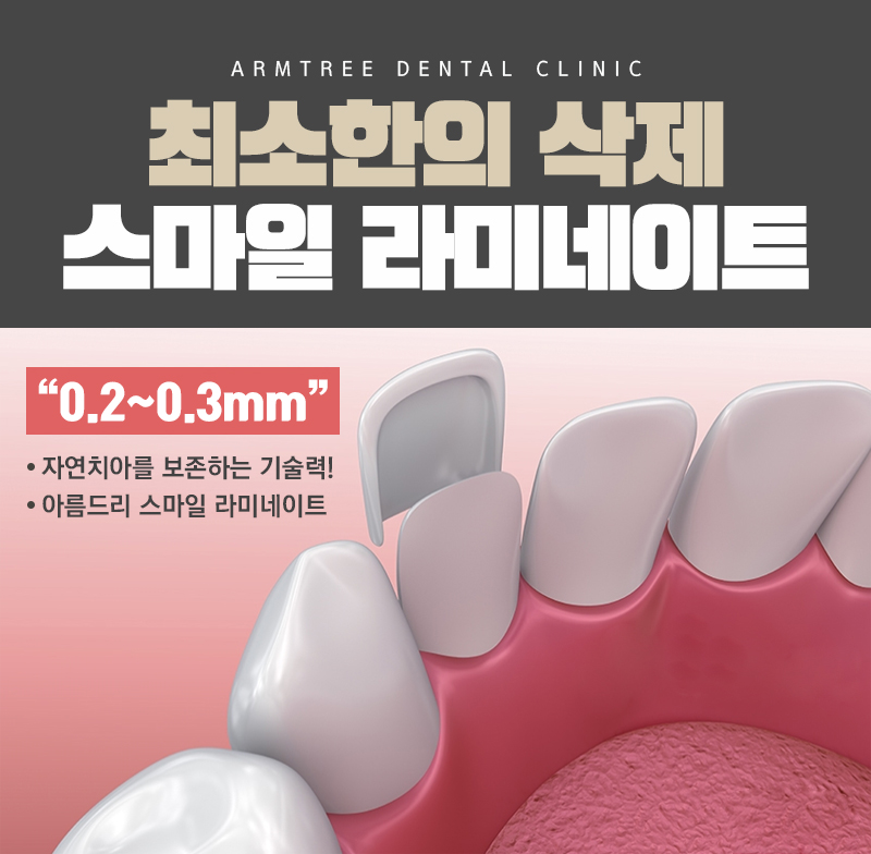 토끼이빨라미네이트 누런이 문제없음 관련 이미지 6