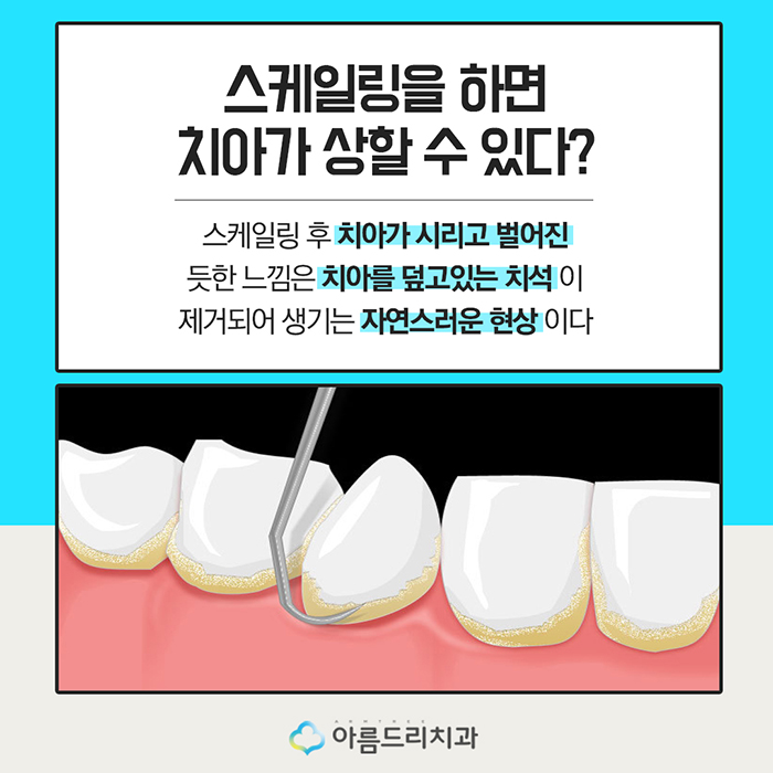 김성은 박수진 연예인 치과 인스타그램 관련 이미지 6