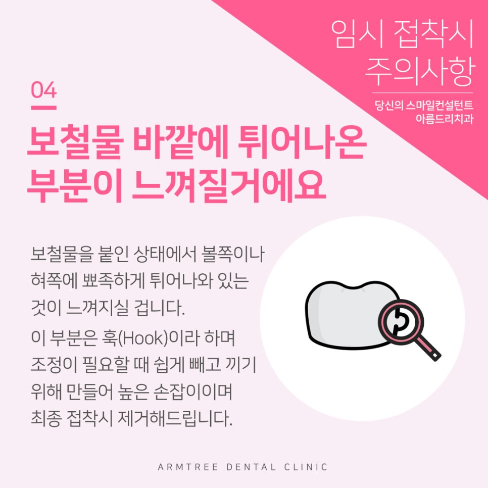 치과 크라운치료 세팅 주의사항 관련 이미지 5