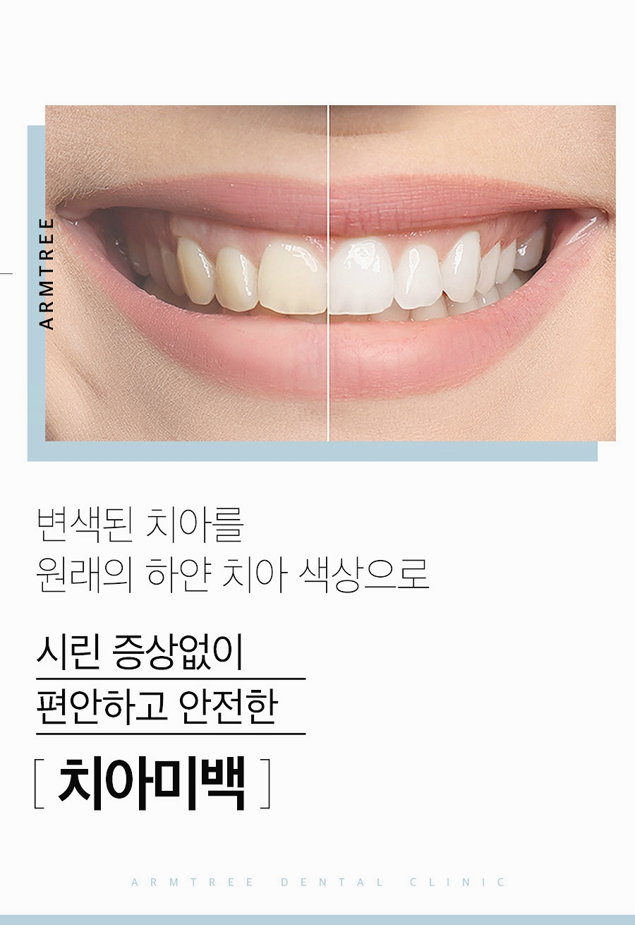 치과치아미백 확실하게 신논현역 아름드리치과 관련 이미지 2