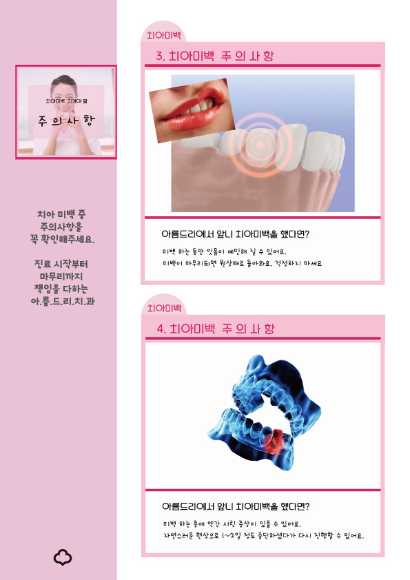 치아미백 꼭 알아야 하는 주의사항 확인하세요 관련 이미지 6