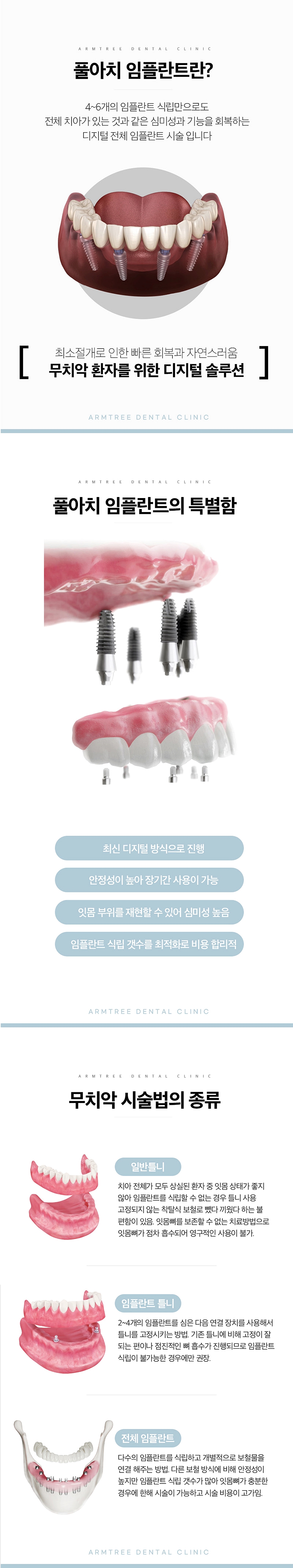 전체임플란트 풀아치임플란트는 아름드리치과라면 관련 이미지 2