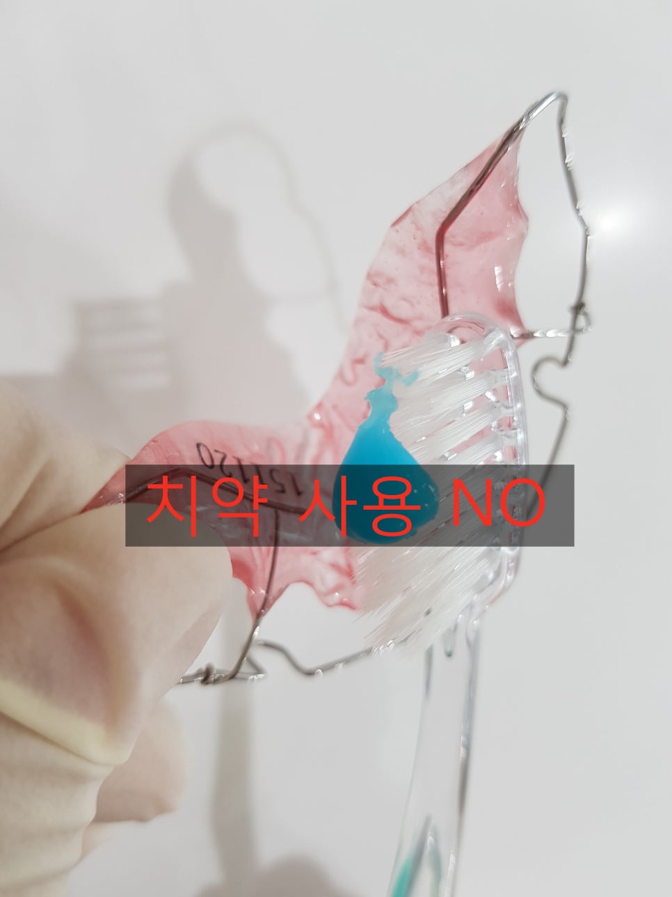 치아교정 후 유지 장치 세척&관리법 Tip_강남 아름드리 치과 관련 이미지 14