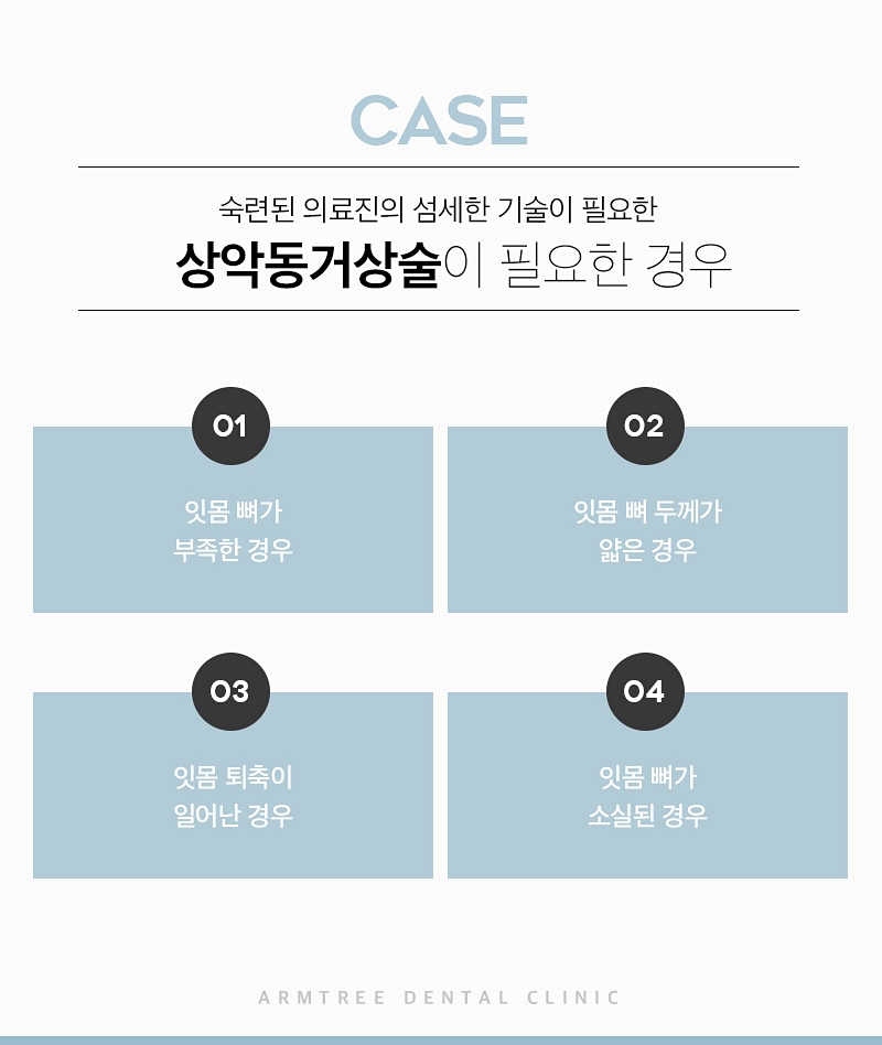 상악동거상술 부작용없는 아름드리치과 관련 이미지 6