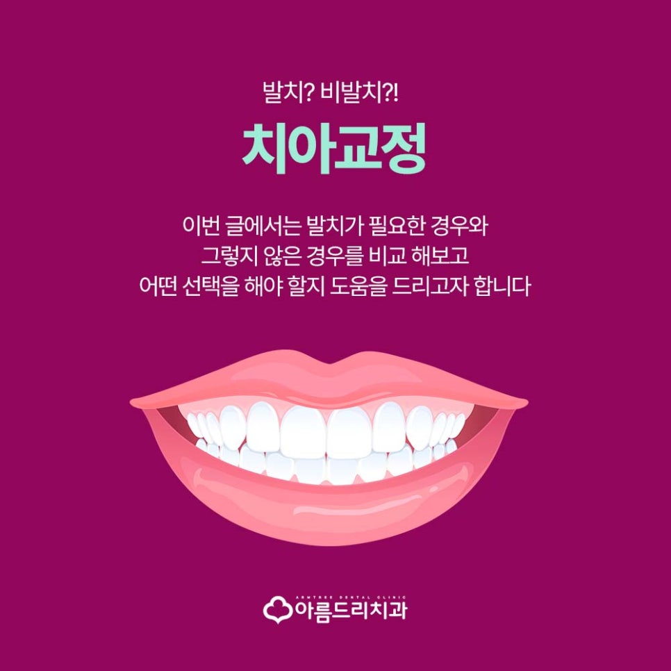 신논현역 강남역 치아 교정 발치 정밀검사 필요성 관련 이미지 1