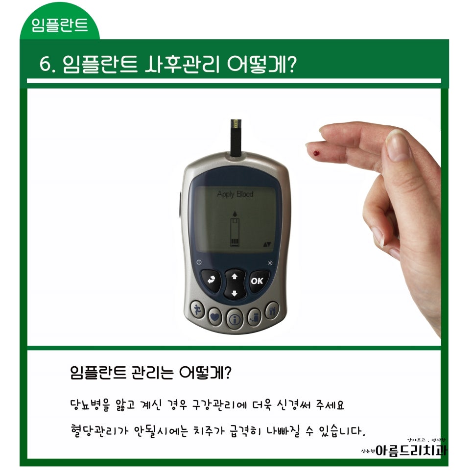 신논현역 치과_임플란트 지켜야 할 주의사항!!!_아름드리 치과 관련 이미지 8