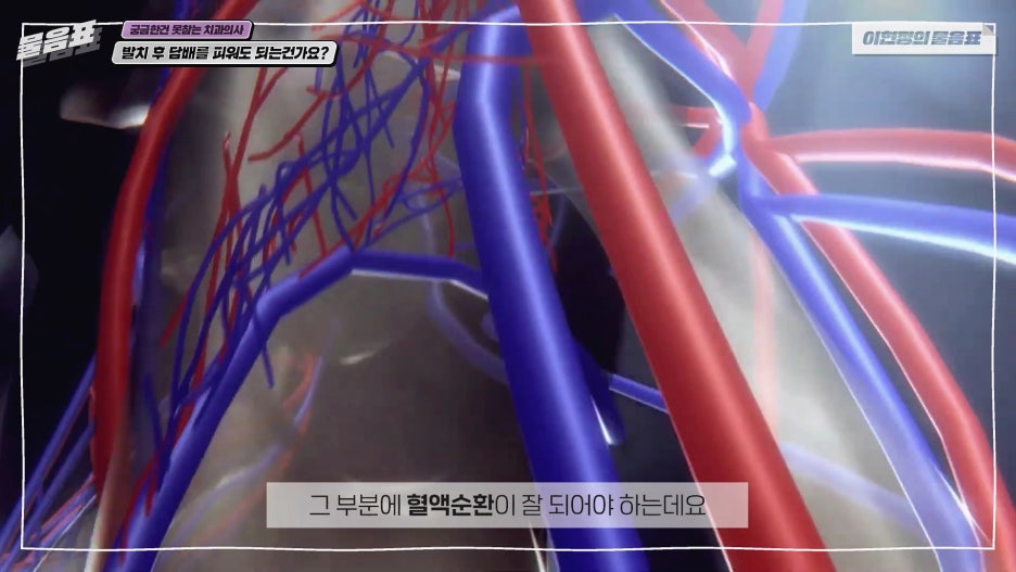 발치 후 흡연 안되는 이유? 치아상식 이현정의물음표 관련 이미지 7
