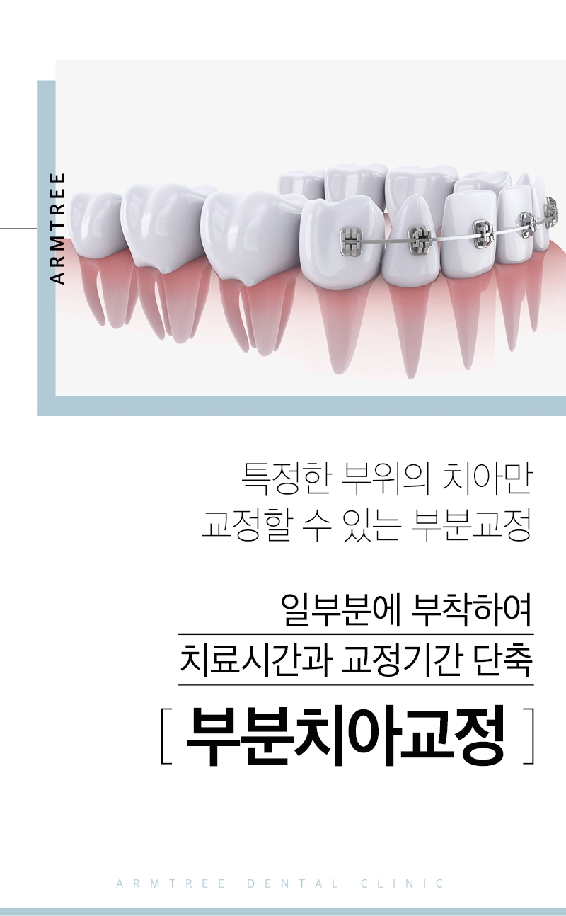벌어진앞니부분교정 신논현역 아름드리치과 관련 이미지 2